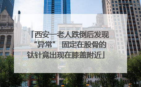 西安一老人跌倒后发现“异常” 固定在股骨的钛针竟出现在膝盖附近